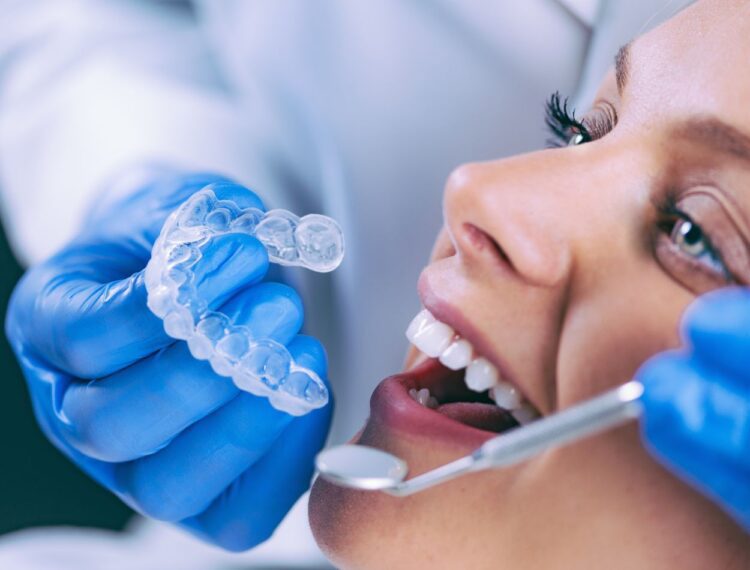 Clareamento Dental Veja Tudo Que Voc Precisa Saber Sobre O Assunto