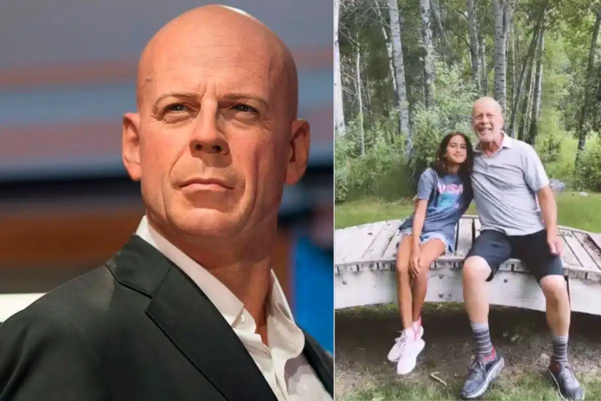 Cos è l afasia la malattia di Bruce Willis Scopri i segni i sintomi