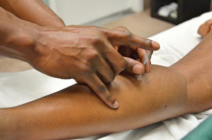 benefícios da acupuntura terapias holísticas benefícios da acupuntura terapias holísticas