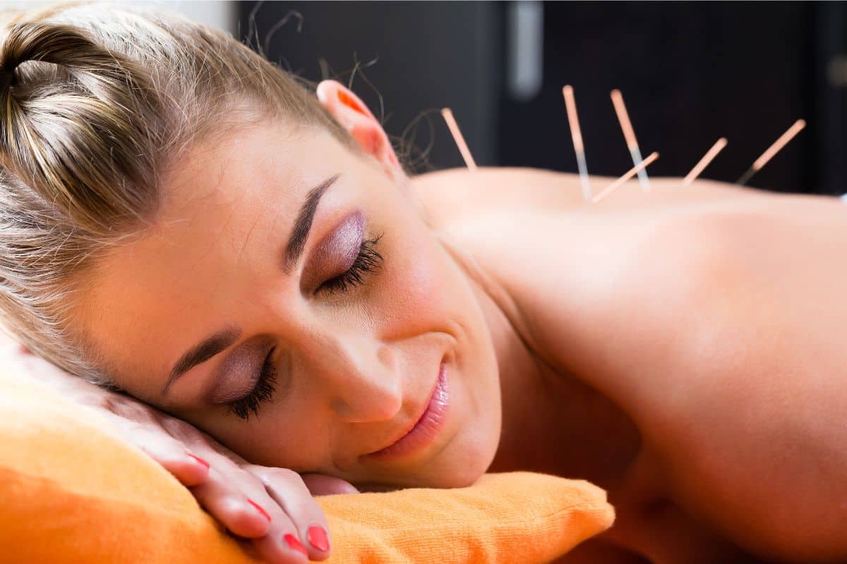 benefícios da acupuntura para mulheres