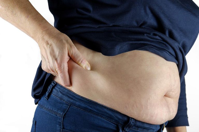 Obesidade e disbiose: conheça a relação entre elas e saiba como evitar 1 obesidade e disbiose