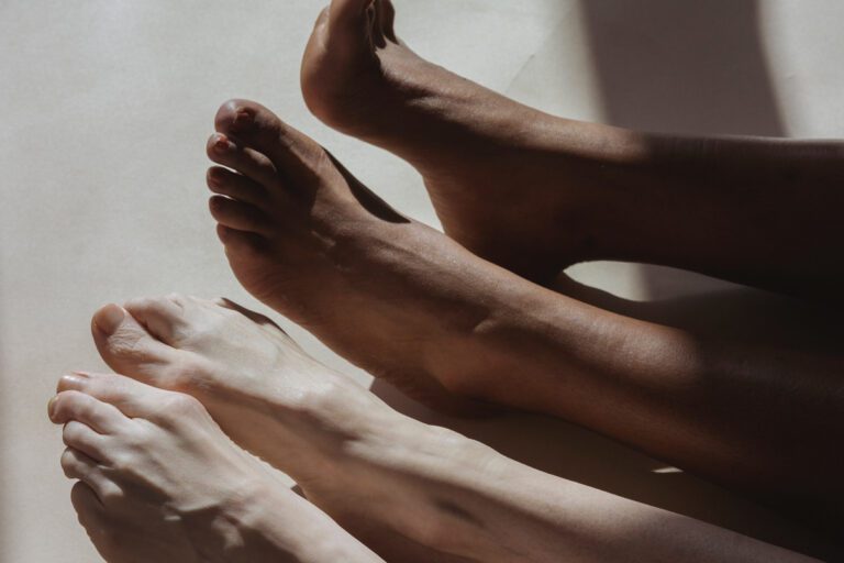 bicho geográfico na pele