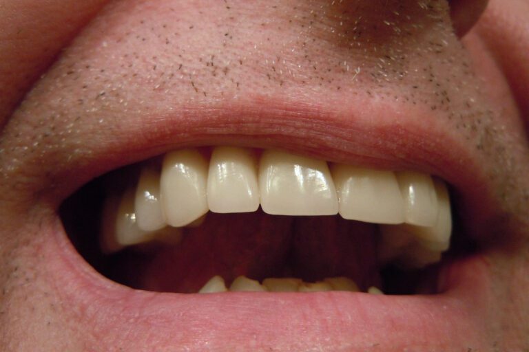 causas do mau hálito