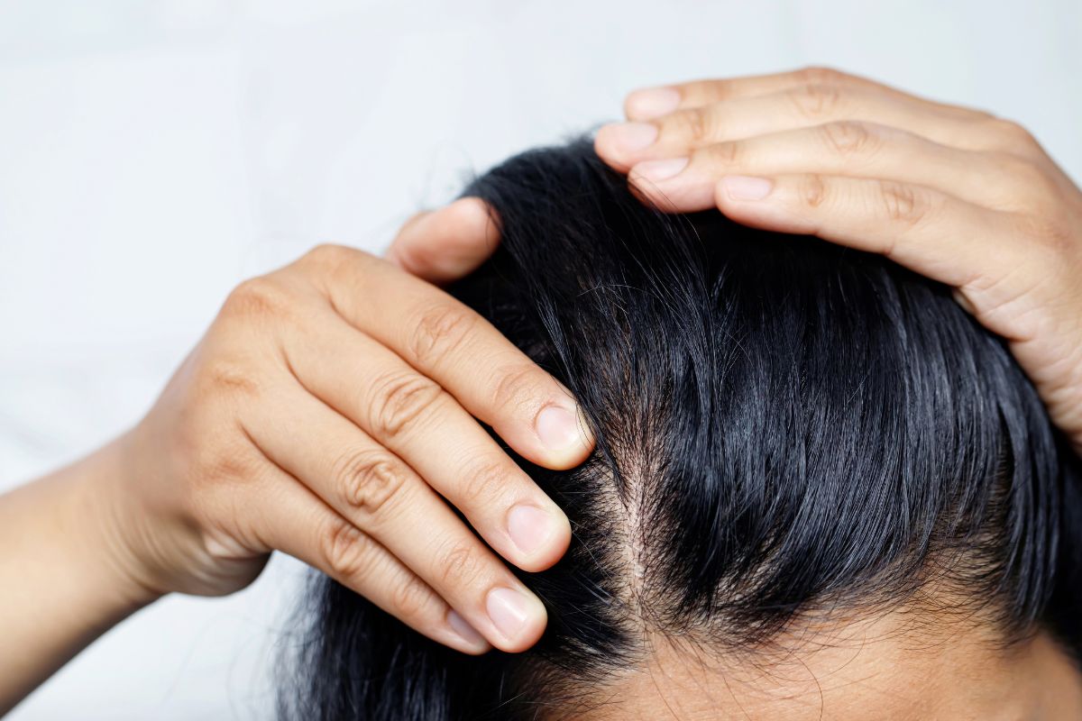 Shampoo a seco é bom para quem tem caspa? Fique atento(a) a essas dicas 1 cabelo com shampoo a seco