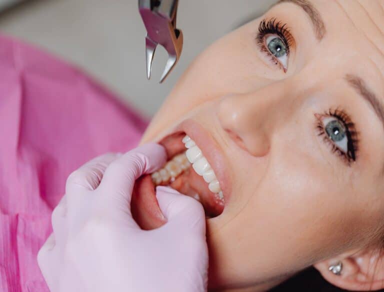 Como higienizar a boca após extração de dentes? Esses 3 passos não podem faltar 1 Como higienizar a boca após extração de dentes