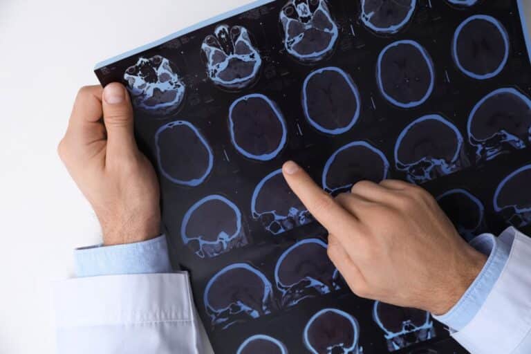Você sabe a diferença entre tomografia e ressonância magnética? Descubra agora 1 médico avaliando tomografia