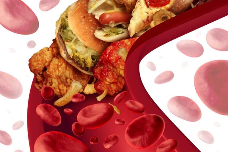 O que significa triglicerídeos alto