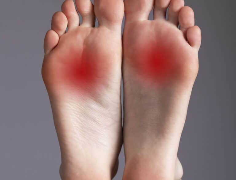 Neuroma de Morton: sapatos apertados ou com bico fino podem causar tumores nos pés 1 neuroma de morton