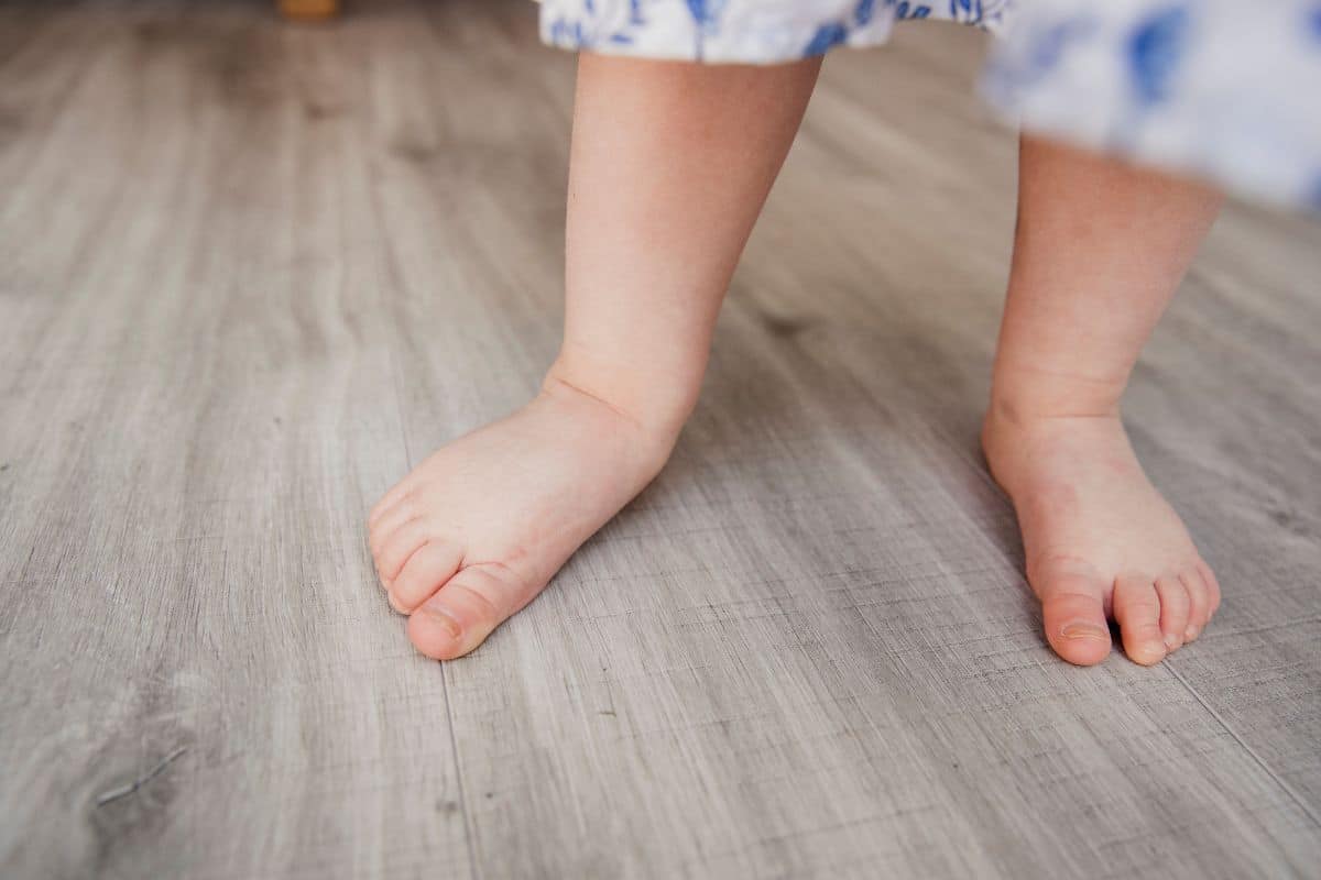 O que são tipos de pisada pronada e supinada? Veja os problemas que elas podem causar 3 tipos de pisada pronada