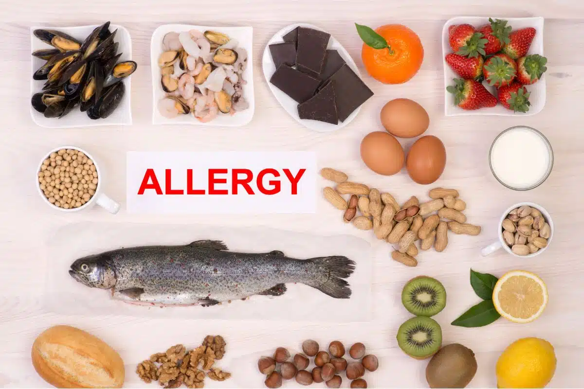 alimentos causadores de alergia alimentar