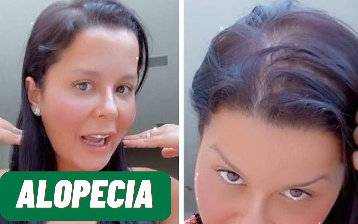 Maraisa com alopecia