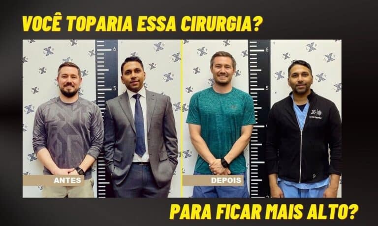 Você toparia? Cirurgia para aumento de altura faz sucesso na China 6 Cirurgia para aumento de altura