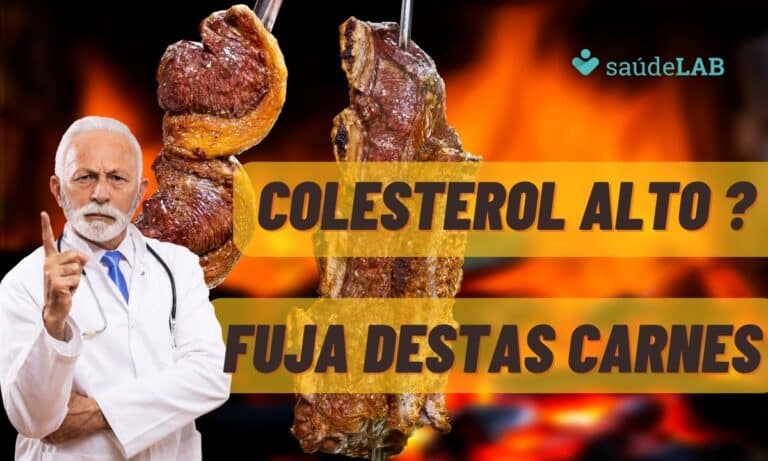 Colesterol alto? Veja quais os cortes de carne que devem ser evitados 2 Colesterol alto? Veja quais os cortes de carne que devem ser evitados