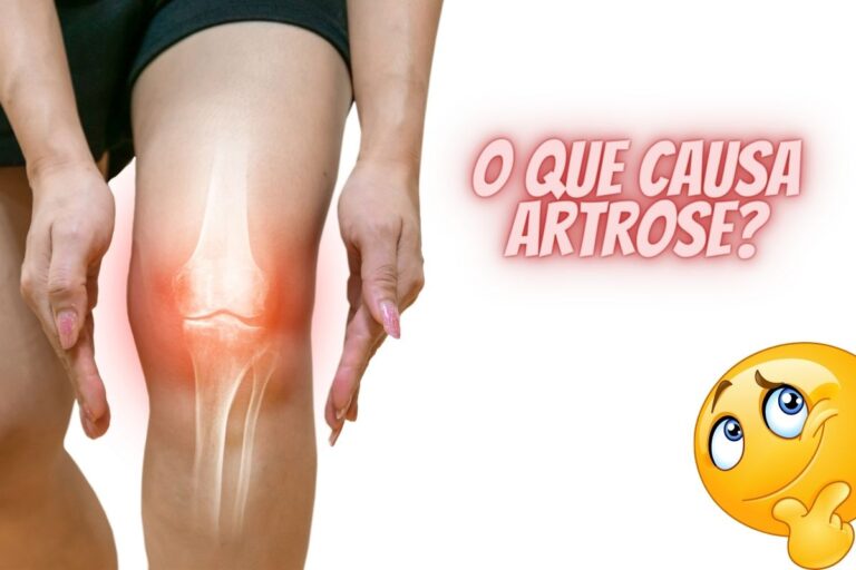 O que é artrose e quais as causas? Tem tratamento? Descubra agora 7 causas de artrose no joelho