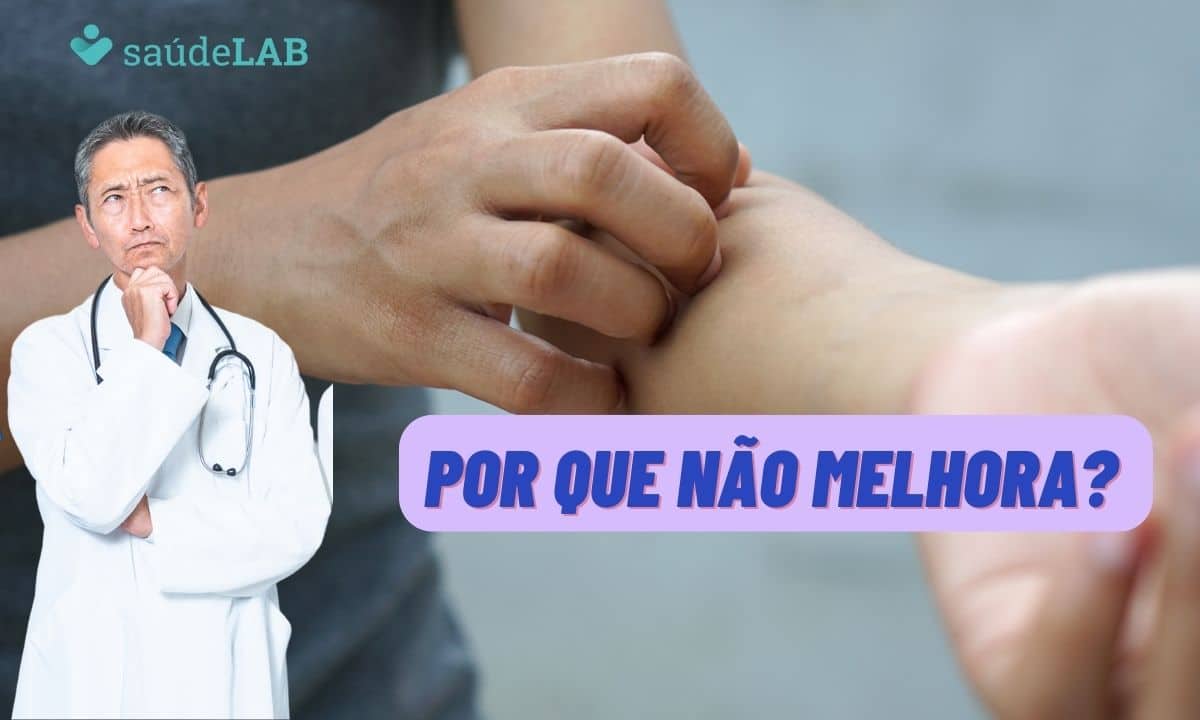 A micose não melhora? Descubra os hábitos que contribuem para isso 1 A micose não melhora