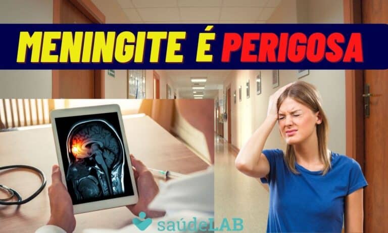 Meningite pode levar a morte ou deixar sequelas; conheça os primeiros sintomas 3 Meningite