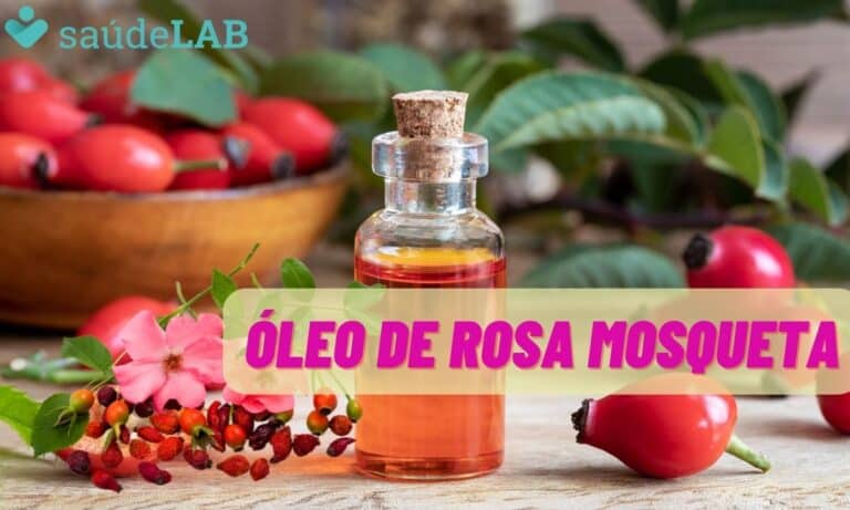 Óleo de Rosa Mosqueta