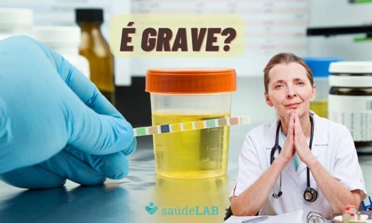 Presença de proteína na urina: quais são as causas? É algo grave? 5 Presença de proteína na urina