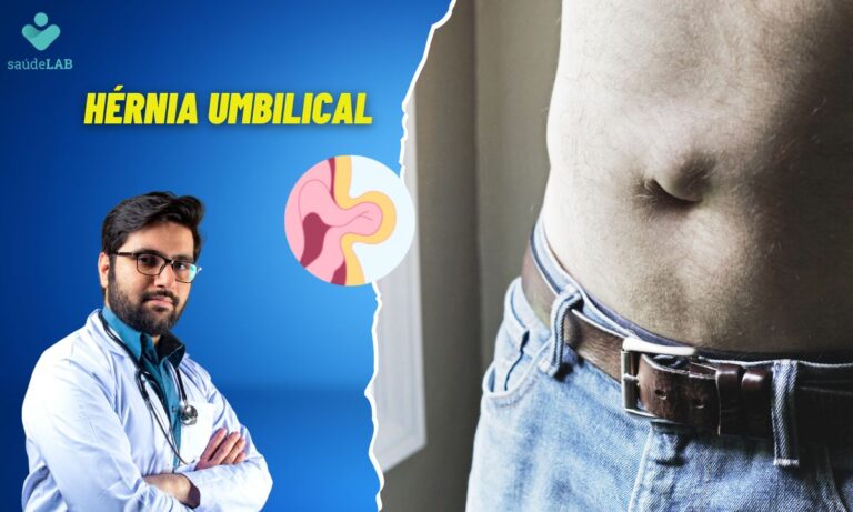 Hérnia Umbilical: quais são as causas? Tem como prevenir? Saiba mais 3 Hérnia Umbilical.