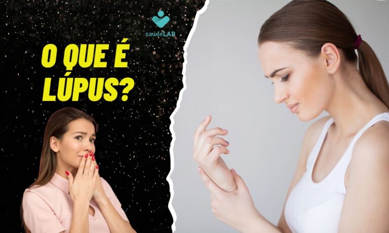 O que é lúpus?