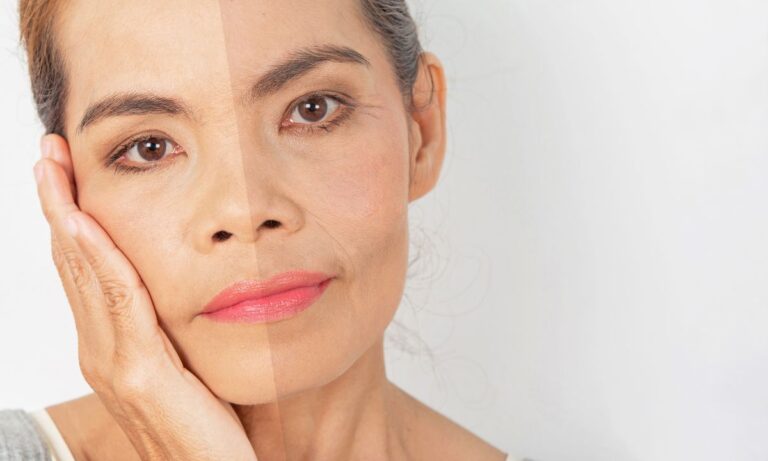 Bigode chinês: quais são os melhores tratamentos para dar fim nele? 4 Bigode Chinês.