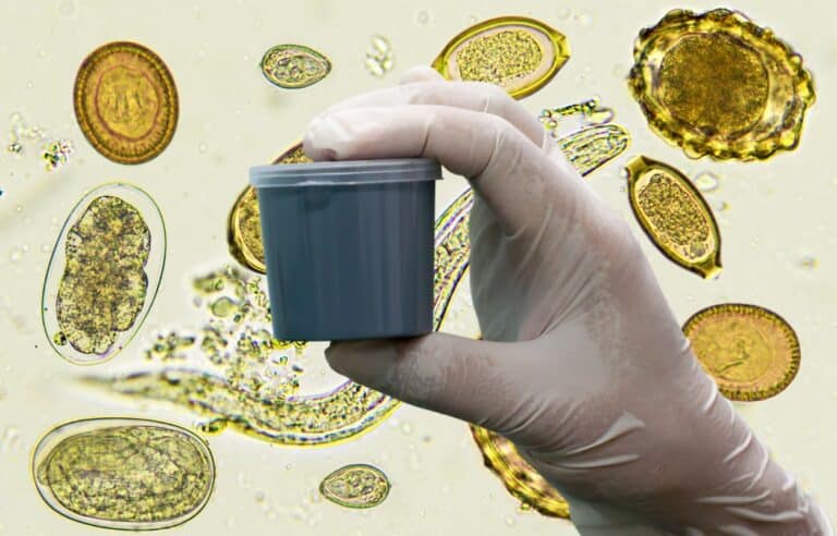 Saiba como armazenar amostra para exame de fezes corretamente 5 Armazenar Exame de Fezes.