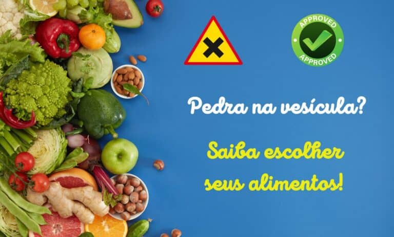 Dieta para quem tem pedra na vesícula: conheça os alimentos liberados e proibidos 1 Dieta para quem tem pedra na vesícula.