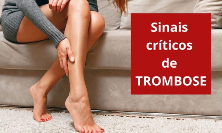 Sintomas de trombose.
