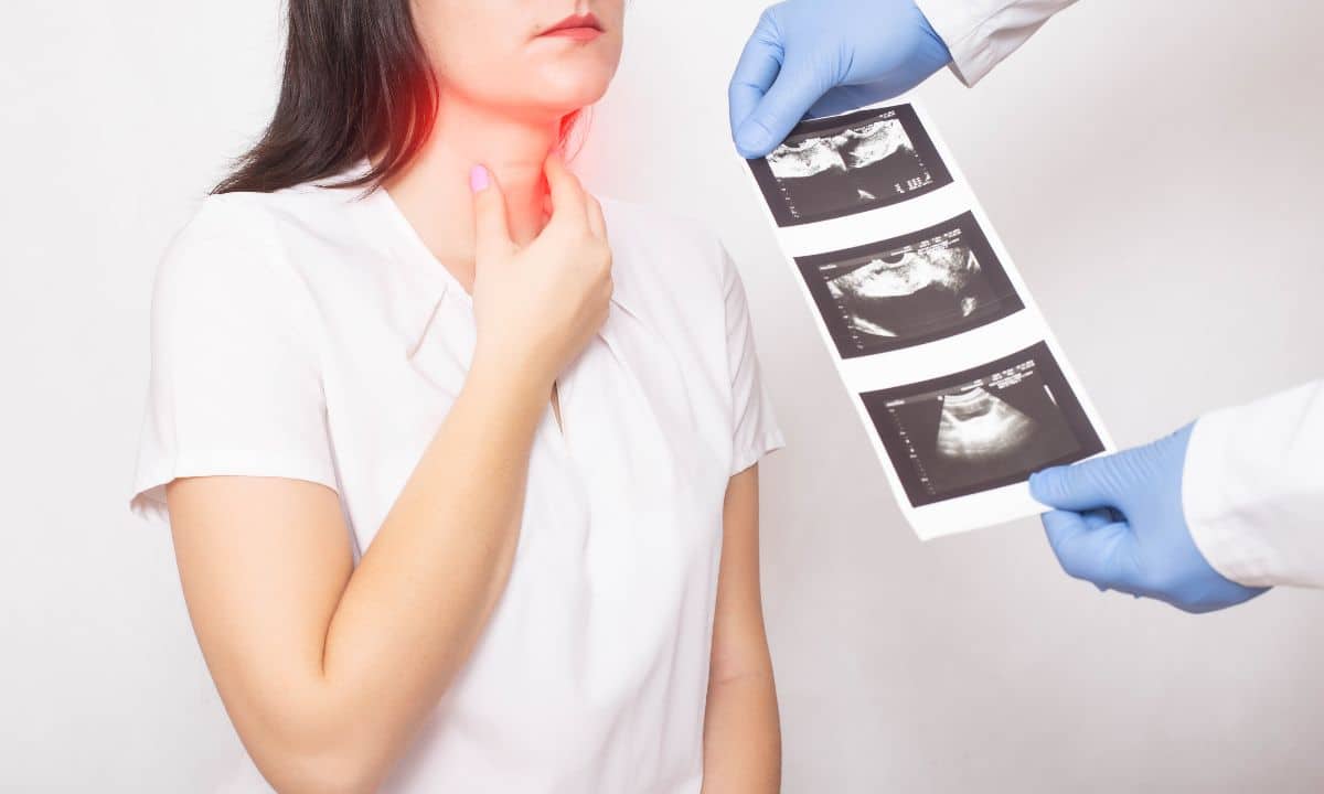 Sua tireoide está doente? Conheça os principais sinais de que você precisa de um médico 1 Tireoide Doente.