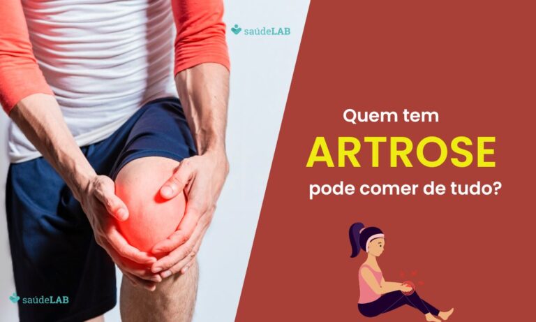 Alimentação para artrose.