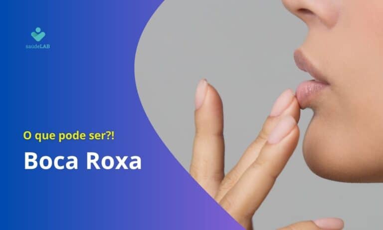 Boca Roxa, o que pode ser?!