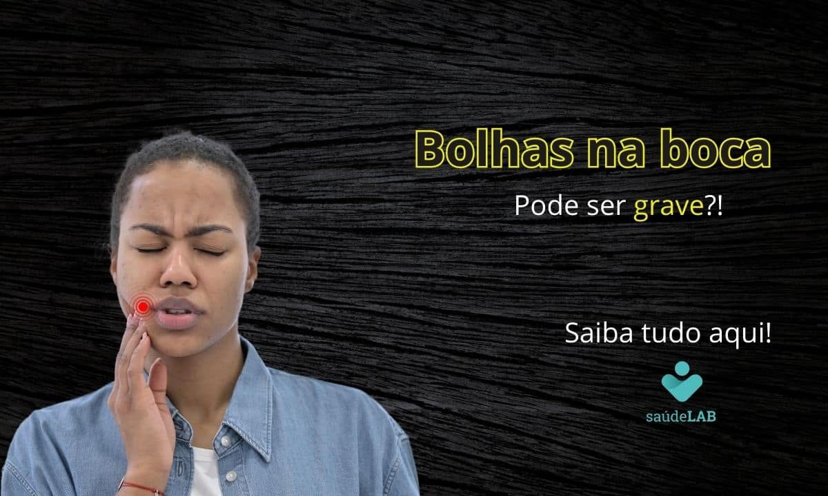 Bolhas na boca: o que elas podem ser? Como resolver esse problema? 1 Bolhas na boca, o que pode ser?