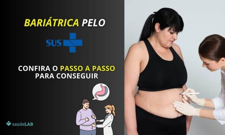 Como conseguir bariátrica pelo SUS? Descubra o passo a passo necessário 7 Como conseguir cirurgia bariátrica pelo SUS.