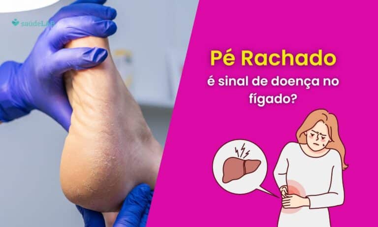 Pé rachado e problema no fígado.