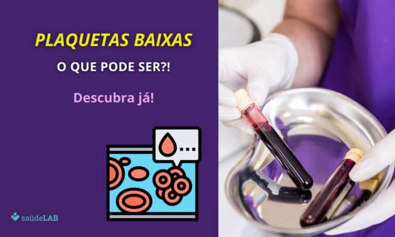 Plaqueta baixa: o que pode ser? Entenda aqui as 13 causas mais comuns para aceder o alerta 6 Plaquetas baixas o que pode ser?