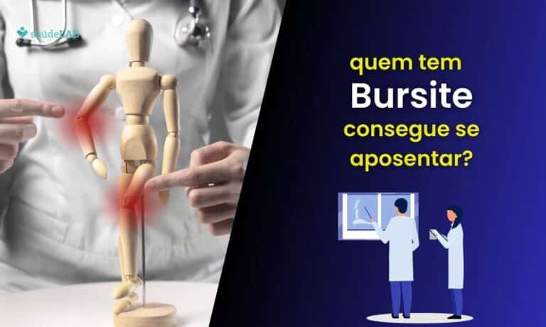 Bursite aposenta? Saiba como funciona aposentadoria por invalidez 4 Bursite aposenta.