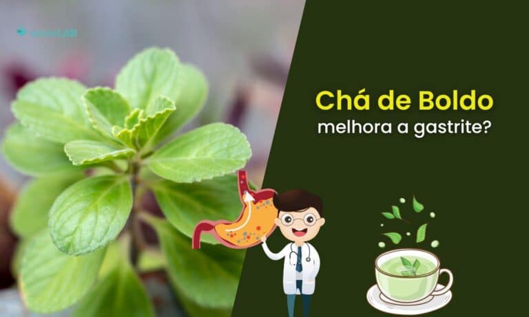 Chá de boldo é bom para gastrite? Saiba de que forma ele pode ser benéfico 4 Chá de boldo é bom para gastrite.