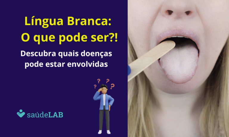 Língua Branca: o que pode ser?!