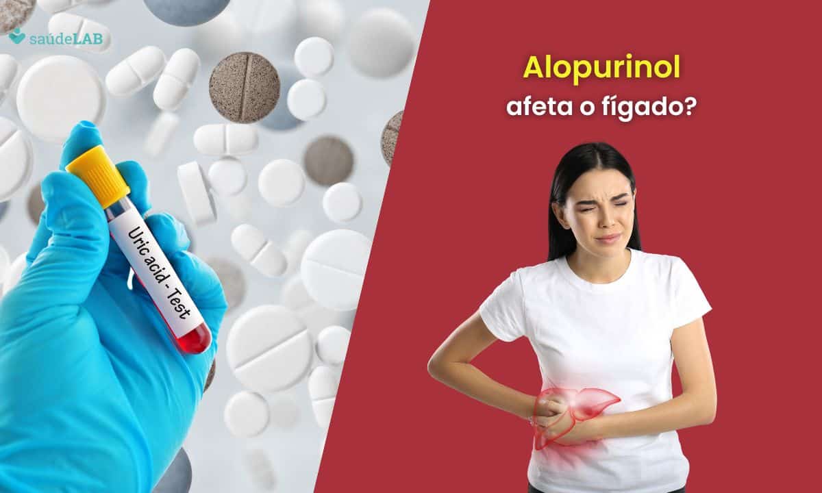 Alopurinol faz mal para o fígado? Entenda este e outros efeitos 1 alopurinol faz mal para o fígado.