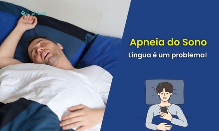 Tamanho da língua importa: Estudo revela o que piora a gravidade da apneia em pacientes 6 Apneia do sono.