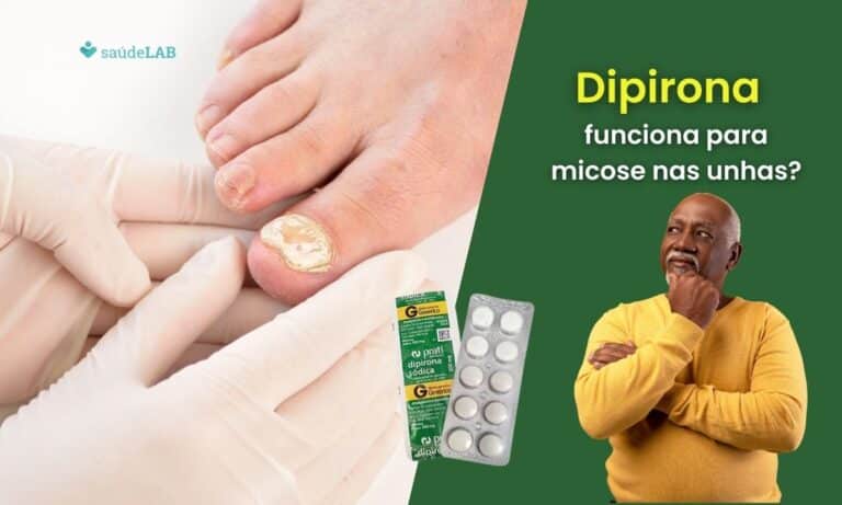 Dipirona para micose nas unhas funciona.