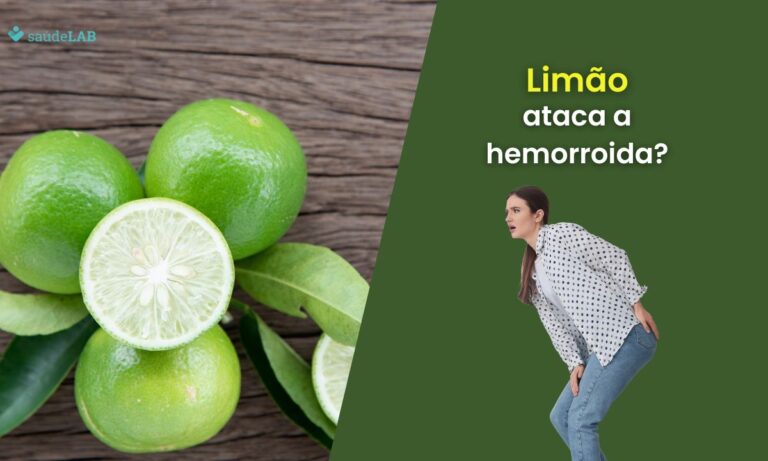 Limão faz mal para hemorroida.