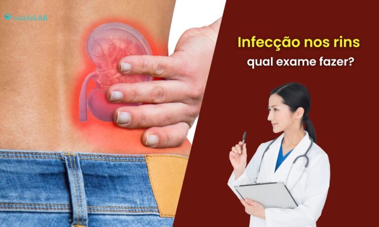 Qual exame detecta infecção nos rins? Saiba o que fazer nesses casos 4 Qual exame detecta infecção nos rins.