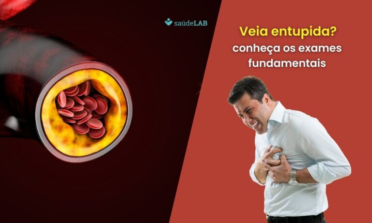 Qual exame detecta veia entupida no coração? Saiba mais e fique atento 8 Qual exame detecta veia entupida no coração.