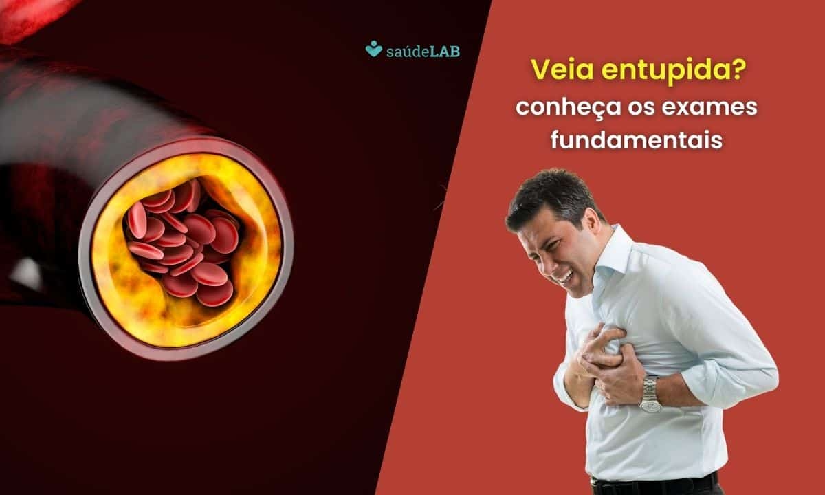 Qual exame detecta veia entupida no coração? Saiba mais e fique atento 1 Qual exame detecta veia entupida no coração.