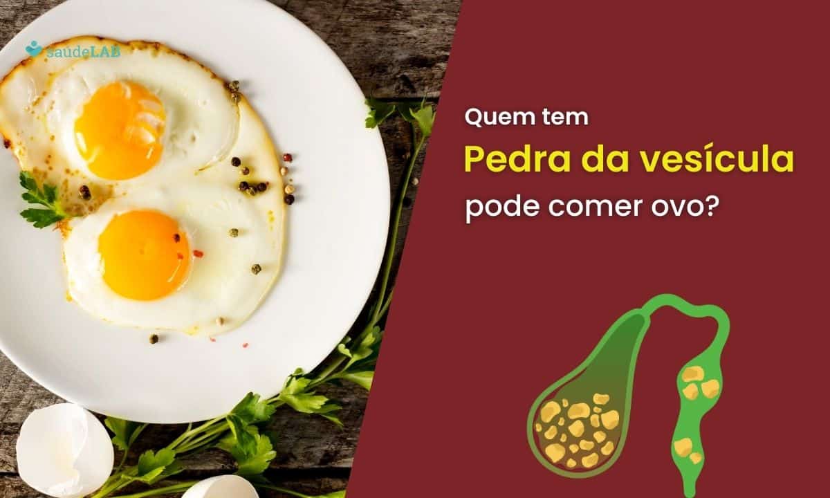 Quem tem pedra na vesícula pode comer ovo? Entenda se ele é seguro 1 Quem tem pedra na vesícula pode comer ovo