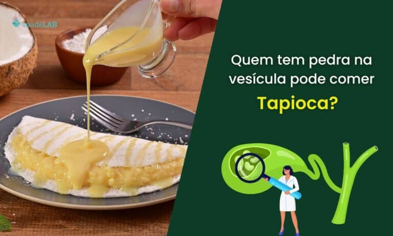 Quem tem pedra na vesícula pode comer tapioca.