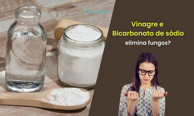 Vinagre e bicarbonato para fungo nas unhas: a misturinha serve? Saiba mais 1 Vinagre e bicarbonato para fungo nas unhas.