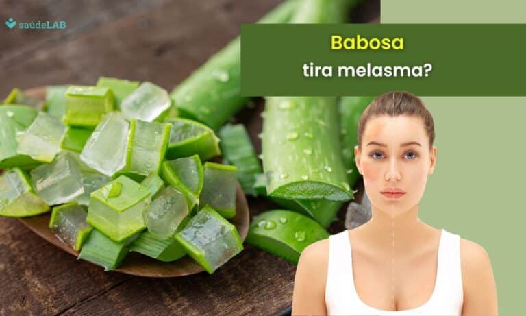 Babosa tira mancha de melasma? Descubra agora como usar a babosa do jeito certo 1 Babosa tira melasma.