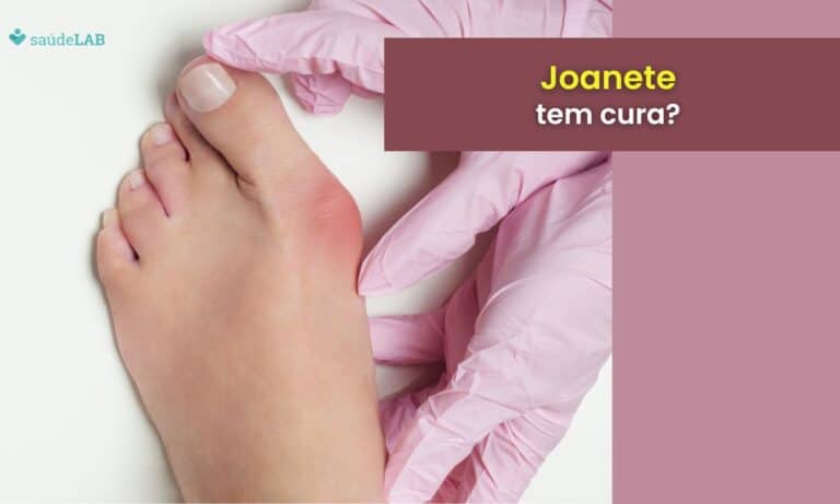 Joanete tem cura? Entenda as causas, complicações e o tratamento adequado 5 Joanete tem cura.